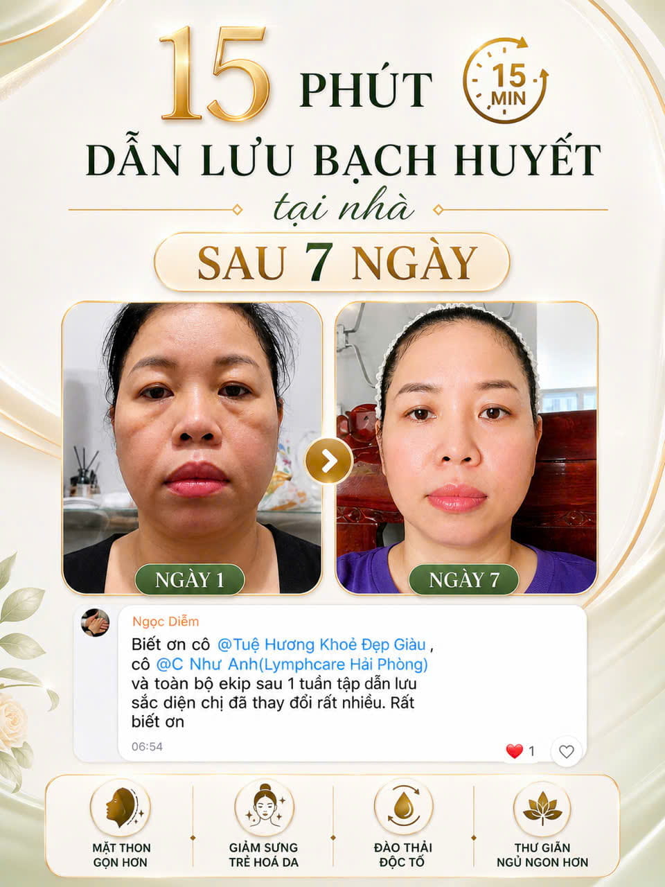Kết quả dẫn lưu bạch huyết tại nhà sau 7 ngày của học viên Ngọc Diễm