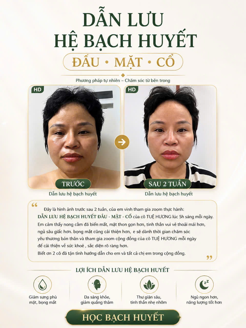 Kết quả dẫn lưu hệ bạch huyết đầu mặt cổ sau 2 tuần thực hành