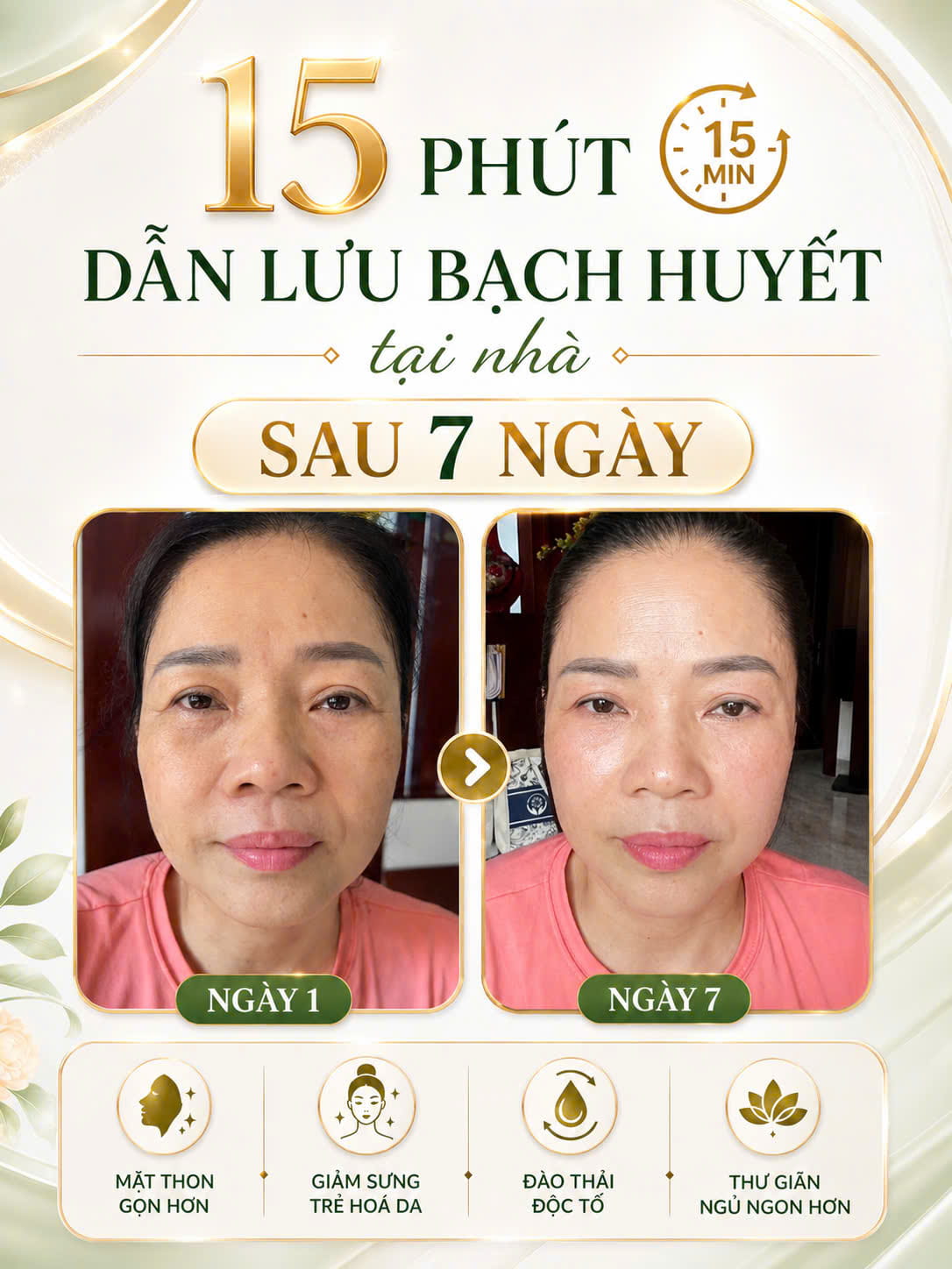 Kết quả dẫn lưu bạch huyết sau 7 ngày - mặt thon gọn, trẻ hoá làn da
